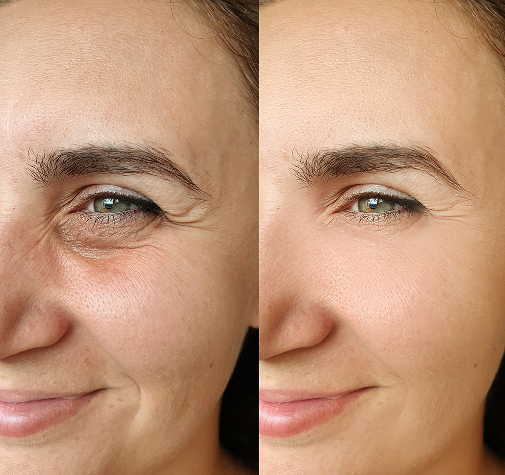 6 Non-surgical Skin-Lifting and Glow-Boosting Skin Treatments