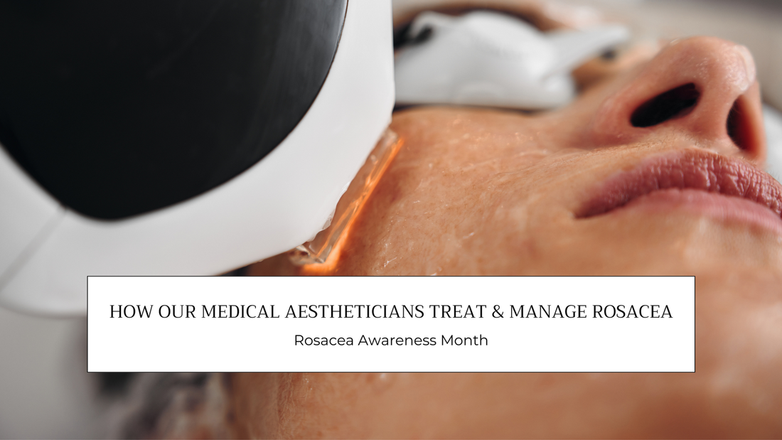 How Our Medical Aestheticians Treat and Help Clients Manage Rosacea