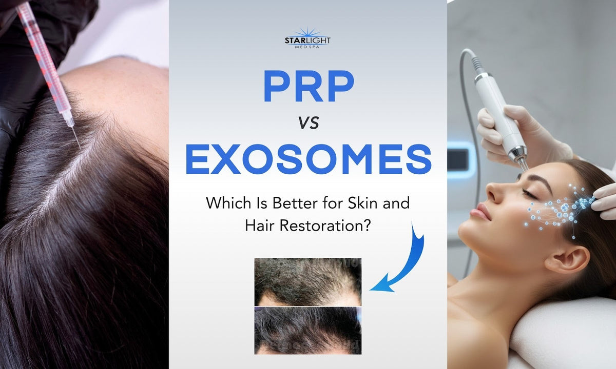 PRP vs Exosomes