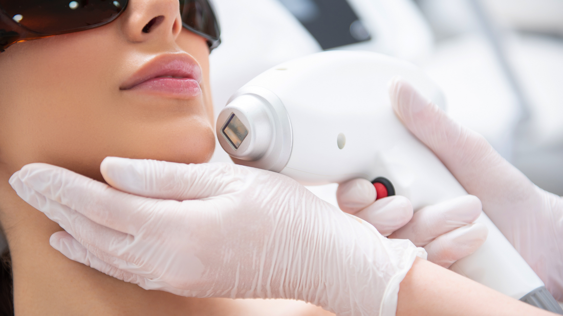 The Benefits of Laser Hair Removal for Acne: Achieve Clear, Glowing Skin