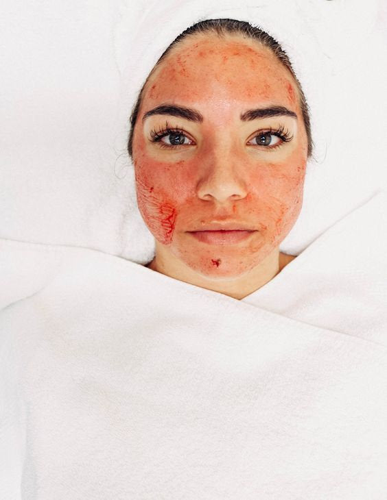 Treatment Downtime: The “Ugly Duckling Phase”