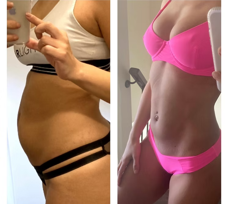 Starlight Body Contouring - 45 Mins