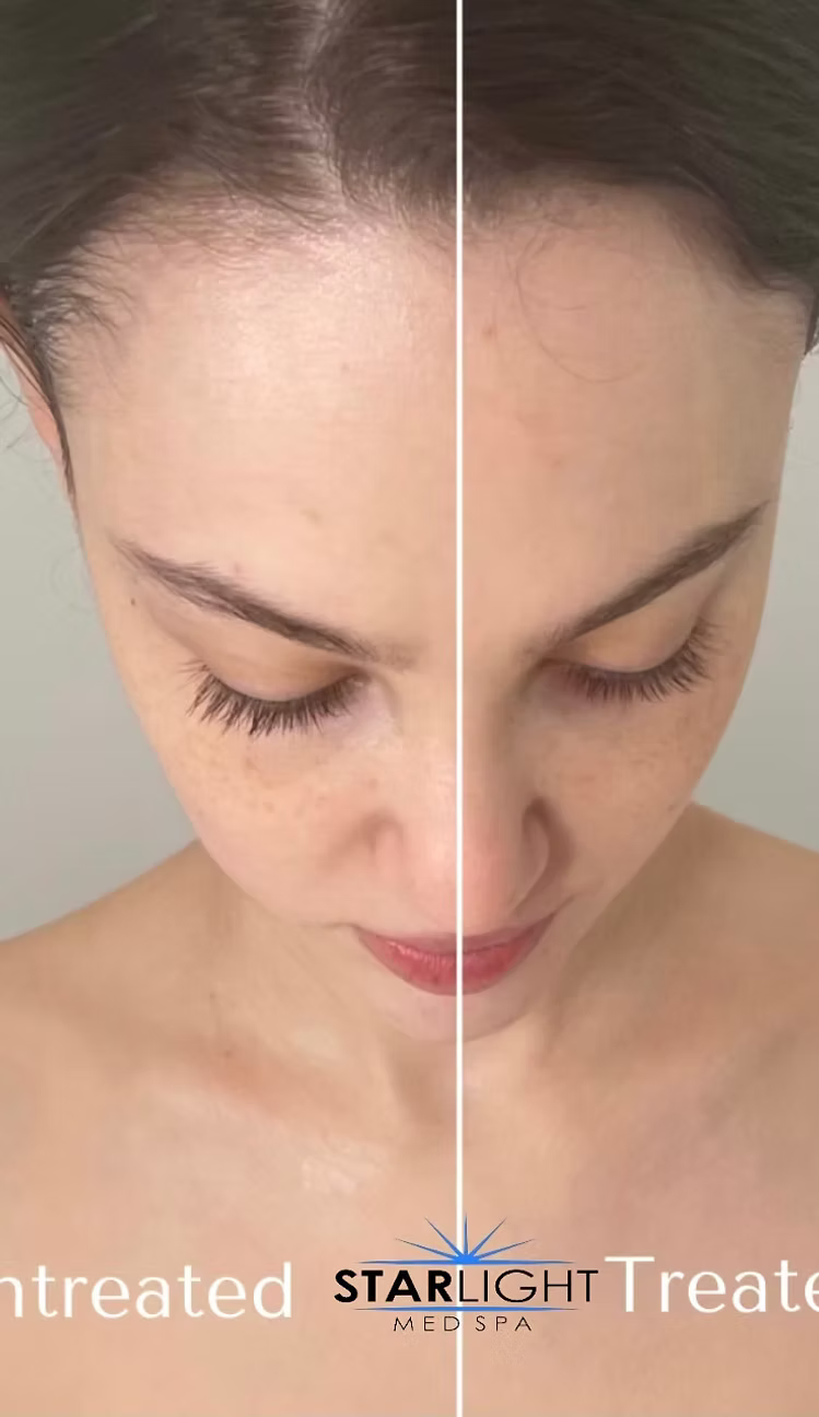FORMA - Face or Neck