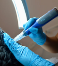 HAIR LOSS REGENERATION