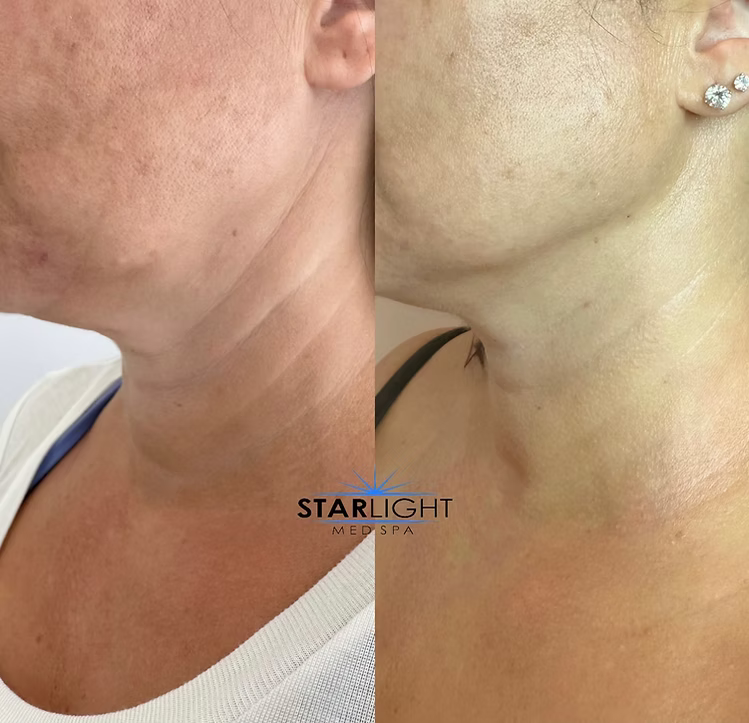 FORMA - Face + Neck