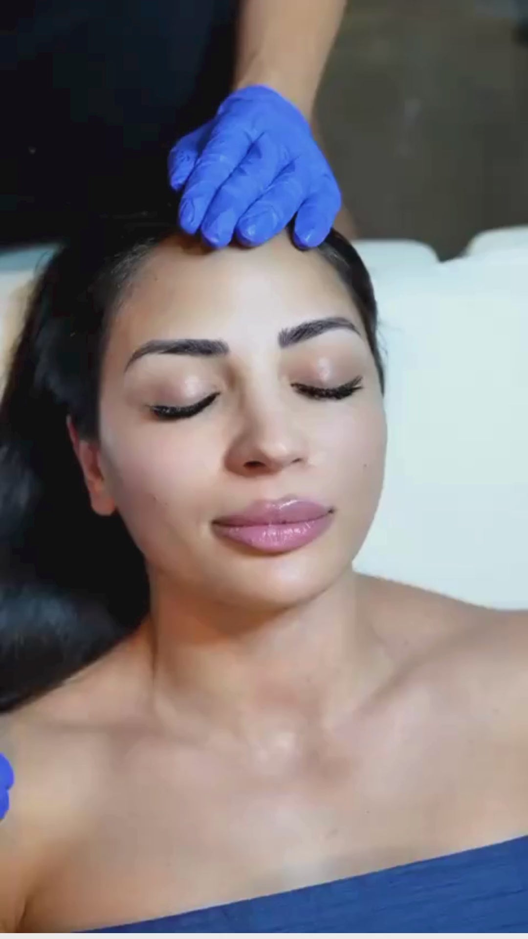 Microneedling treatment at Starlight Med Spa
