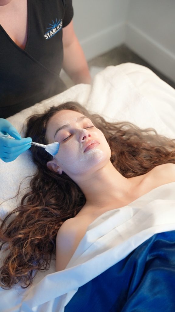 Chemical Peel Facial at Starlight Med Spa